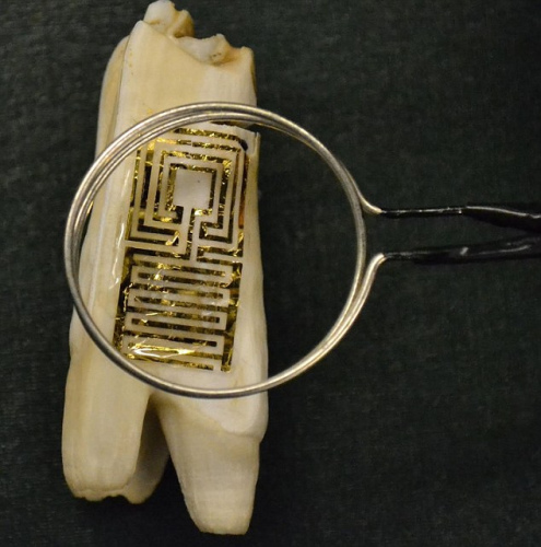 “牙齿文身”实际上是一种石墨烯材料制成的电子芯片传感器，能够通过呼吸采集细菌情报并回传
