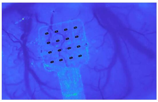 《Nature Materials》：石墨烯可以听见你大脑的“窃窃私语”！