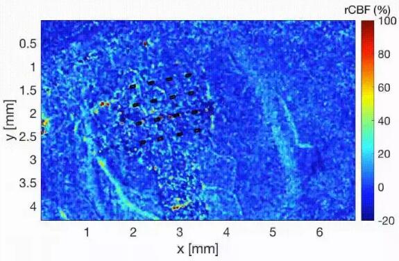《Nature Materials》：石墨烯可以听见你大脑的“窃窃私语”！