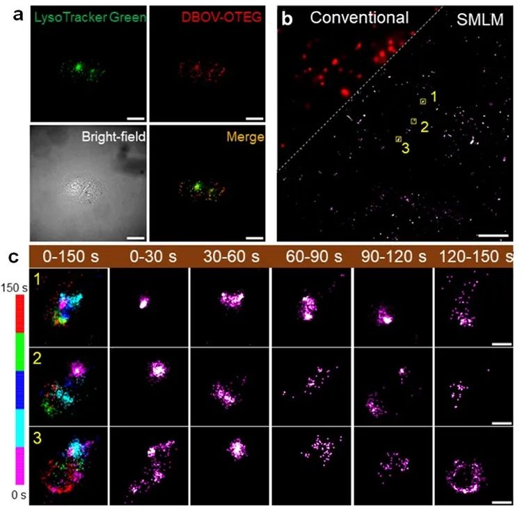 【纳米】合成的自闪烁水溶纳米石墨烯用于光学超分辨生物荧光成像——摆脱传统成像环境的限制