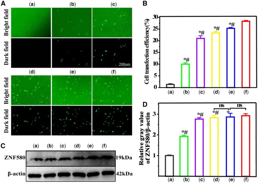 RB 速递 | 天津大学冯亚凯教授和青海民族大学朵兴红副教授团队共同研究成果：聚乙烯亚胺修饰的石墨烯量子点可促进内皮细胞增殖