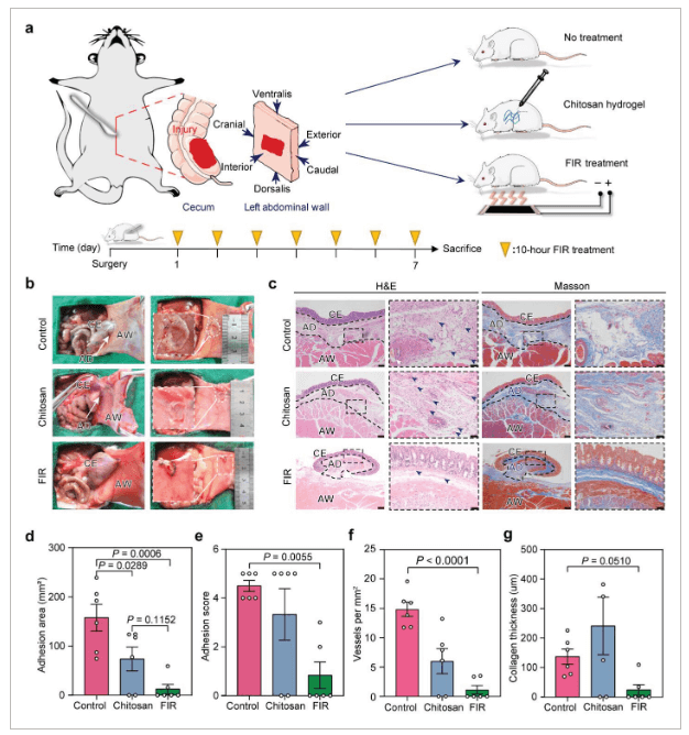 华中科技大学《Adv Sic》：基于石墨烯复合薄膜的可穿戴远红外治疗仪，有效预防术后腹膜粘连