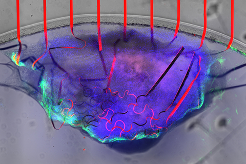 A bioelectronic mesh, studded with graphene sensors (red), can measure the electrical signal and movement of cardiac tissue (purple and green) at the same time. 