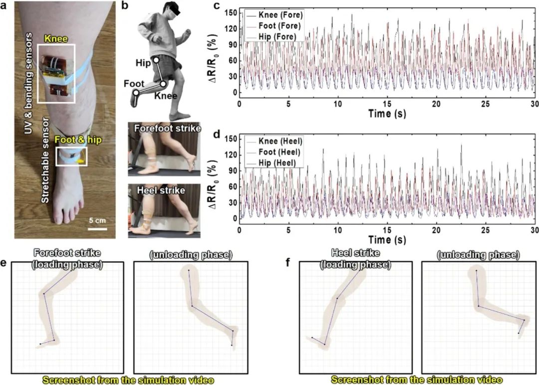 ACS NANO：基于ZnO纳米粒子激光诱导石墨烯的超灵敏可拉伸应变传感器