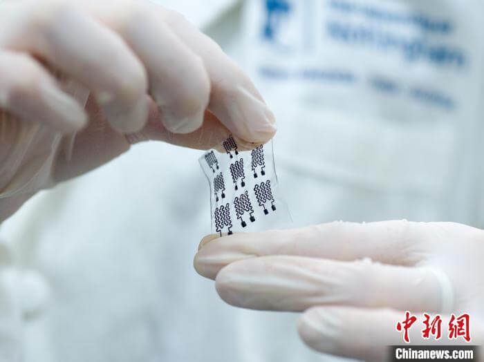 浙江一科研团队研发智能监测贴片 破解皮肤移植术后监测难题