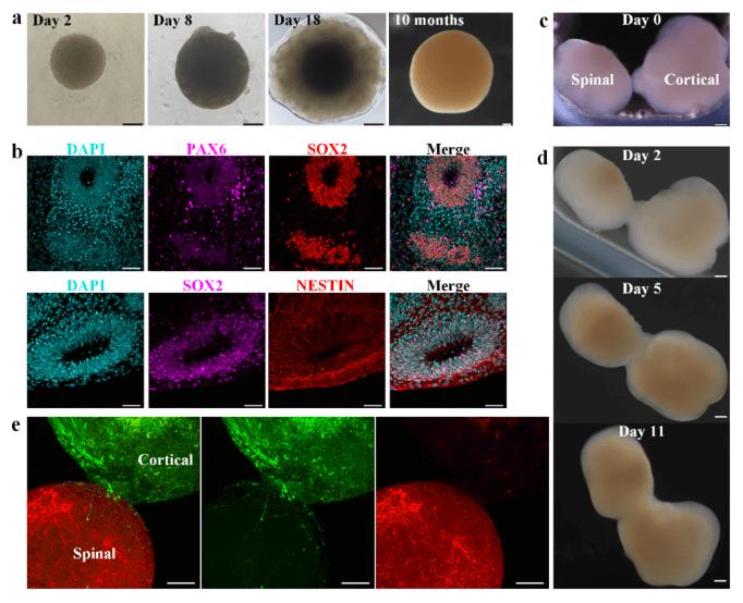 南科大蒋兴宇教授ACS Nano：新型弹性石墨烯微针网状接口实现神经类器官高精度电生理监测