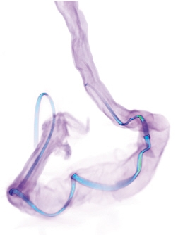 “神经弦”实时侦听大脑与肠道对话 有望实现人体柔软器官生物分子传感