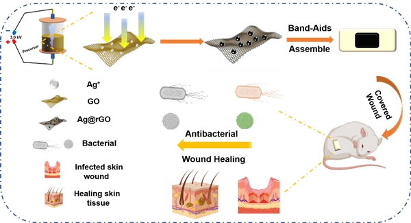 快速绿色制备的银/石墨烯复合材料“创可贴”