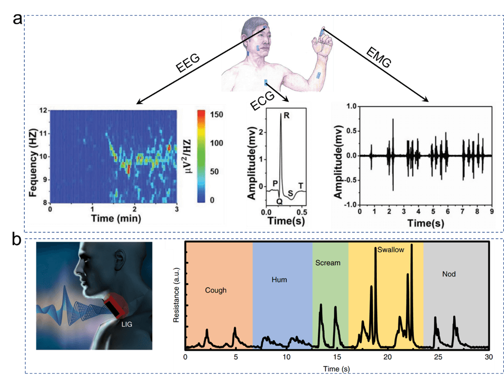 综述：激光诱导石墨烯在智能传感方向的应用