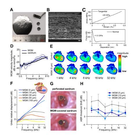 鼓膜功能性修复新进展AHM：石墨烯基薄膜嫁接穿孔鼓膜恢复宽频听力