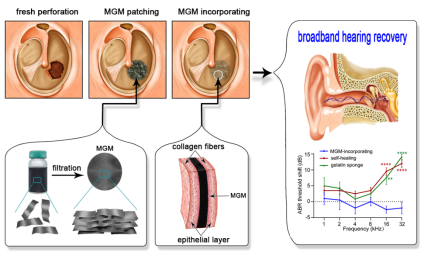 鼓膜功能性修复新进展AHM：石墨烯基薄膜嫁接穿孔鼓膜恢复宽频听力