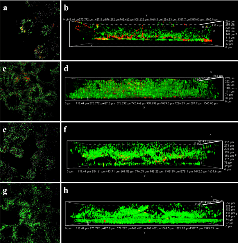 李从举教授，JMCA观点：碳纳米纤维负载石墨烯锚定二硫化钼阳极电催化剂强化微生物燃料电池产电