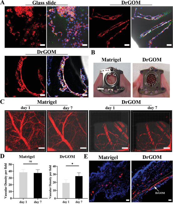 南方医科大学王乐禹教授《AFM》: 心脏修复用不对称疏水/亲水超薄氧化石墨膜的研制！