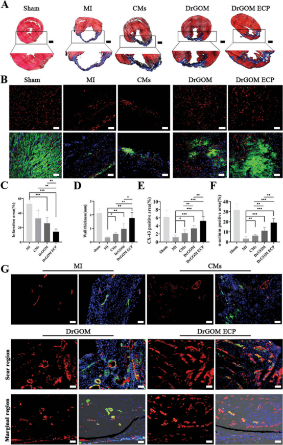 南方医科大学王乐禹教授《AFM》: 心脏修复用不对称疏水/亲水超薄氧化石墨膜的研制！