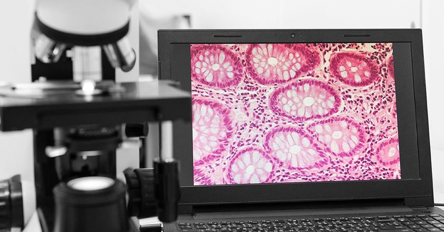 石墨烯旗舰项目：八大商业应用成功案例