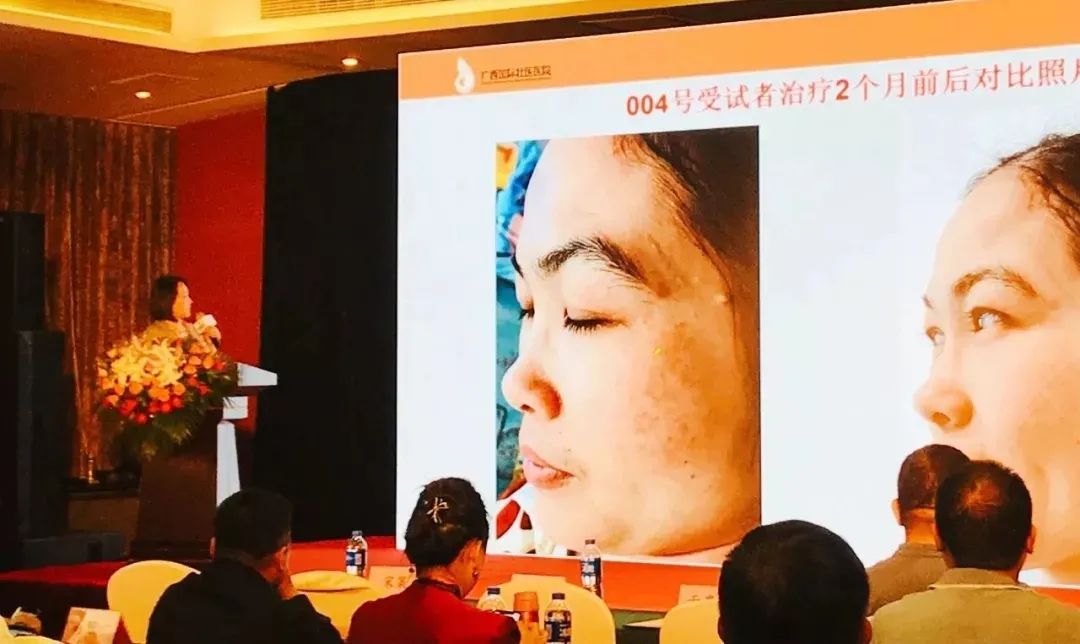 中美协拟新设立石墨烯专委会！携手烯旺赋能美业科技新篇章