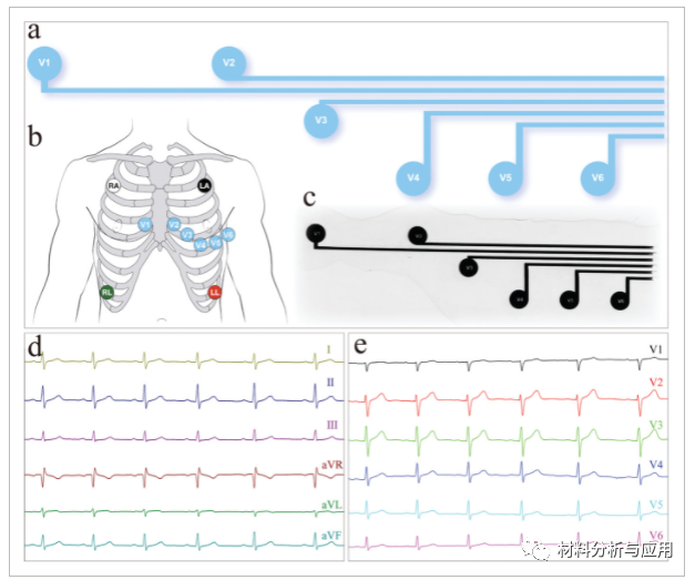 北航《Adv Mater Technol》： PDMS支撑石墨烯表皮干电极，用于可穿戴心电图监测