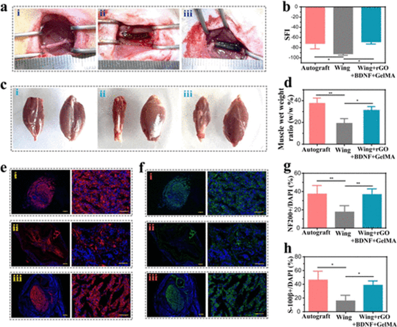 《ACS Nano》东南大学柴人杰/赵远锦：导电拓扑形态蝴蝶翅膀石墨烯/明胶支架用于神经修复！