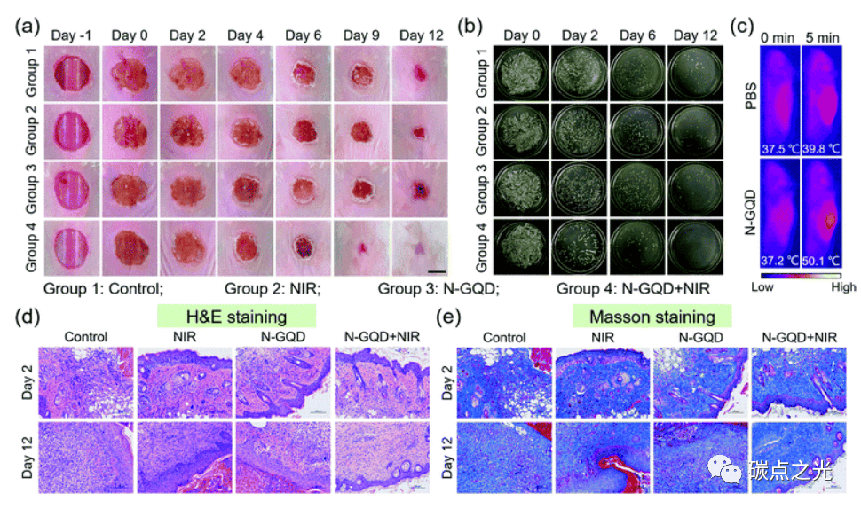 Journal of Materials Chemistry B:N掺杂石墨烯量子点在第二近红外窗口光热消除多重耐药细菌中的应用