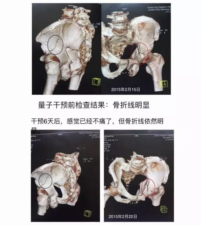 今年的诺奖研究，很容易成为“智商税收割”大户啊……