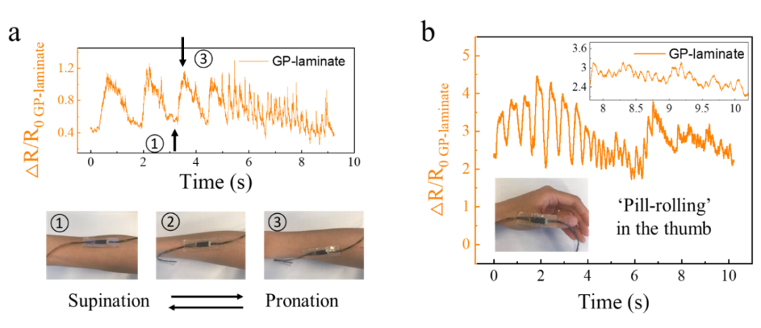 国内外华人科学家开发超柔石墨烯复合材料，首次实现高频肌肉收缩运动可穿戴检测突破