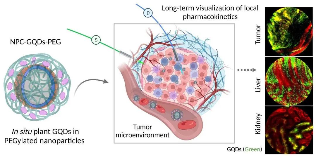 Adv. Mater.: 植入石墨烯量子点用于靶向增强肿瘤成像和局部药代动力学长期可化视