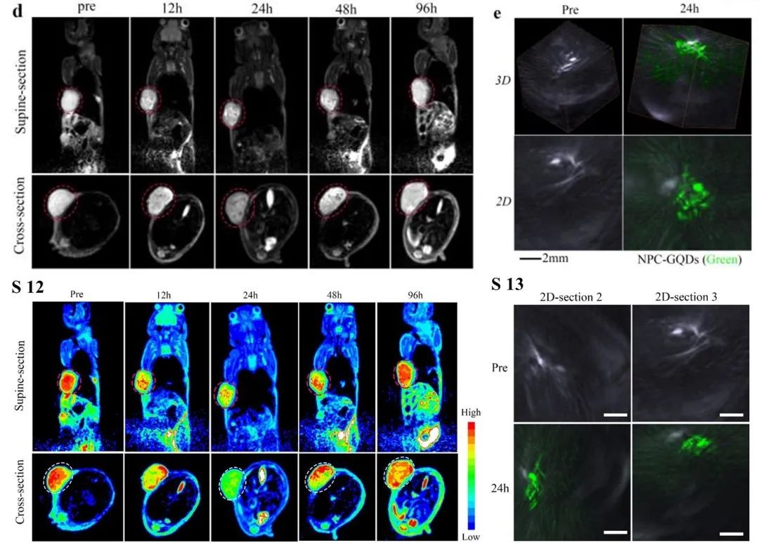 Adv. Mater.: 植入石墨烯量子点用于靶向增强肿瘤成像和局部药代动力学长期可化视