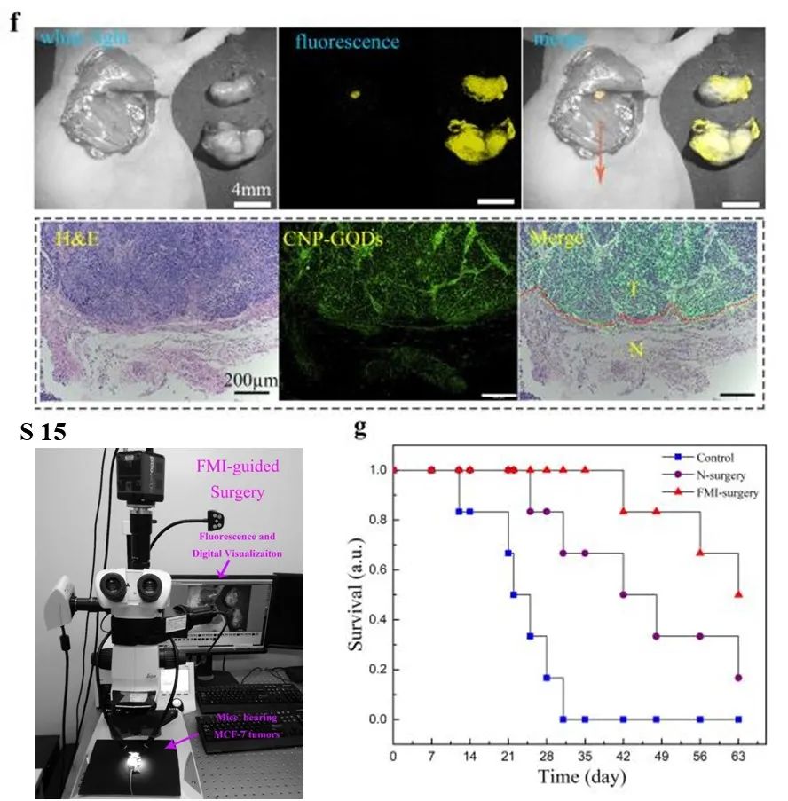 Adv. Mater.: 植入石墨烯量子点用于靶向增强肿瘤成像和局部药代动力学长期可化视