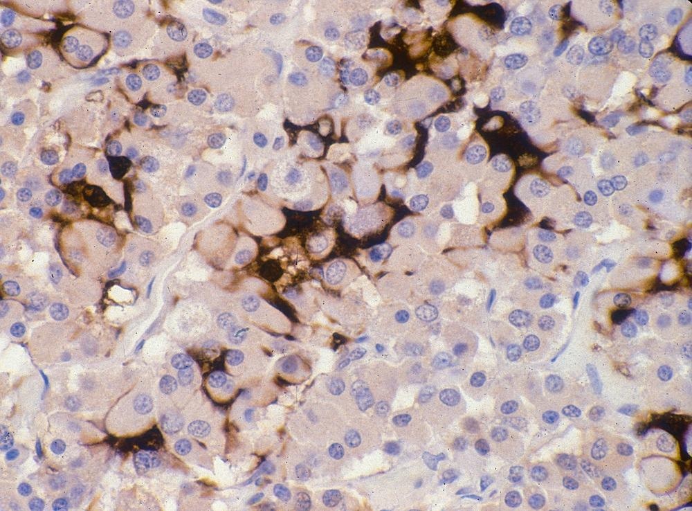 氧化石墨烯纳米材料的形状影响生物物理效应