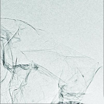 攻坚“石墨烯”—发生在中科院山西煤化所709课题组的故事