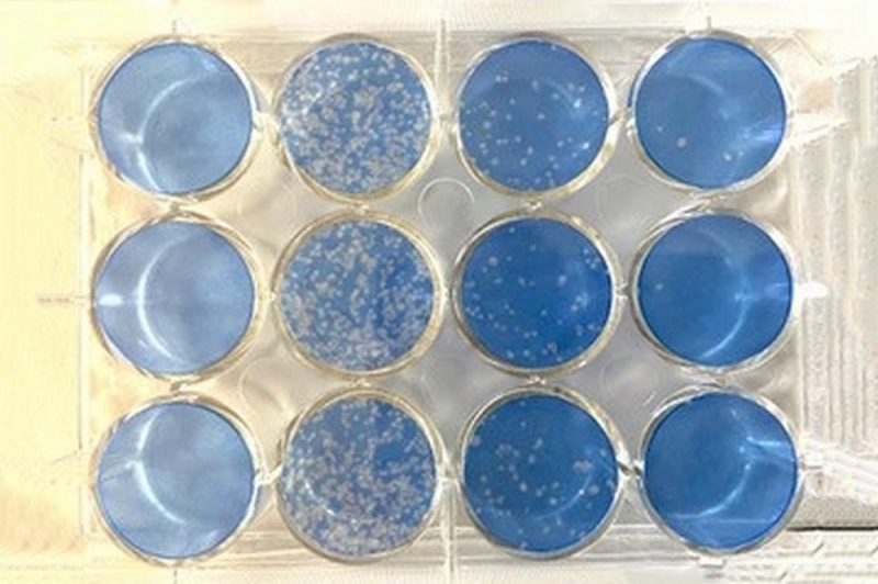 COVID-19：用氧化石墨烯排斥病毒