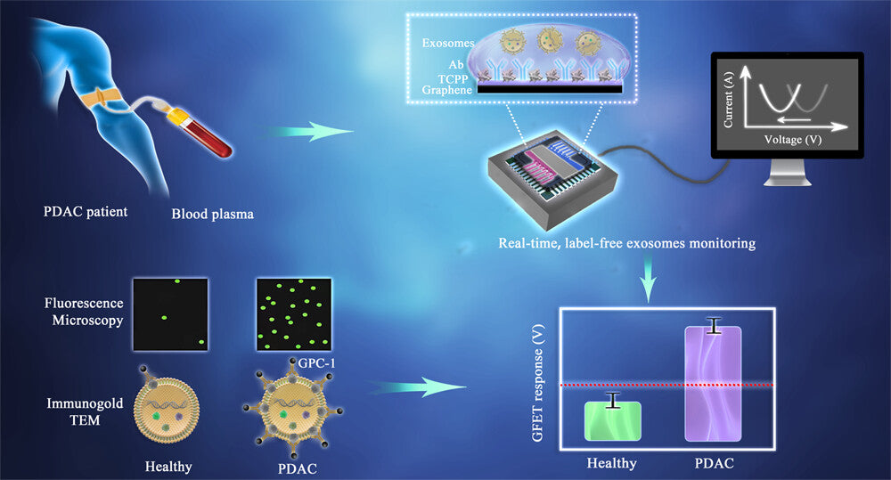 利用石墨烯传感器阵列快速诊断胰腺癌