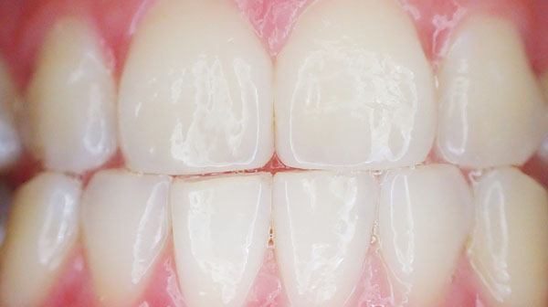 石墨烯在人体中的一些潜在用途