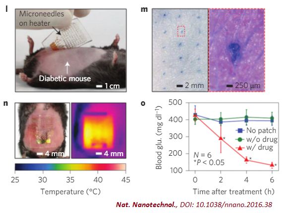 石墨烯可穿戴设备，引发糖尿病监控大变革
