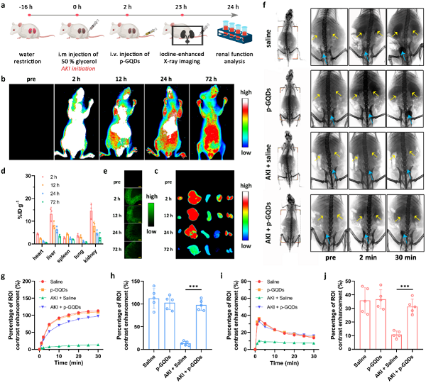 长春应化所Chemical Science：富含类酚基团的石墨烯量子点用于治疗急性肾损伤