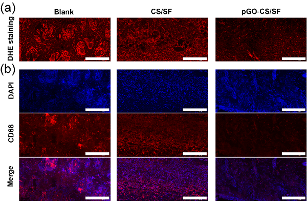 西南交通大学鲁雄教授课题组：多功能电活性仿生支架用于皮肤伤口修复